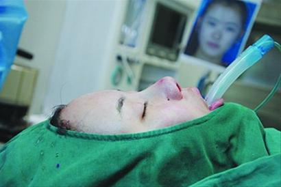 妙齡女沒當(dāng)上空姐發(fā)誓整容 砸15萬挨11刀